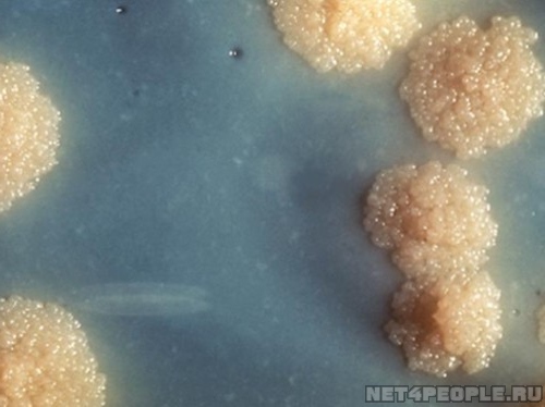 Ученые зафиксировали опасную эволюцию микобактерий туберкулеза
